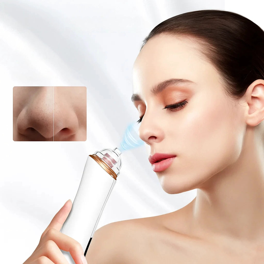 GlowEase | Microdermabrasion Kit – Blackhead Remover – USB Rechargeable – At-Home Skincare Solution Bowlift by Bowlift