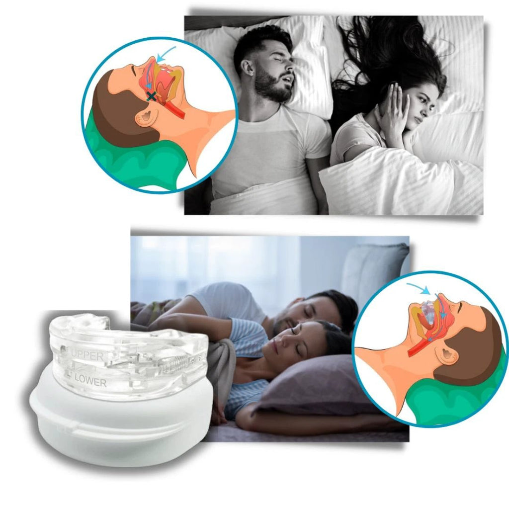 SilentEase | Anti-Snoring Mouth Device – Medical-Grade Silicone – Enhances Airflow – Ideal for Snorers Seeking Better Sleep Bowlift by Bowlift