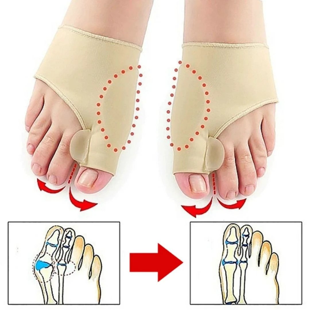 AlignWell Bunion Corrector Toe Separator | for Big Toe Realignment and Pain Relief – Non-Invasive Solution for Bunions Bowlift by Bowlift