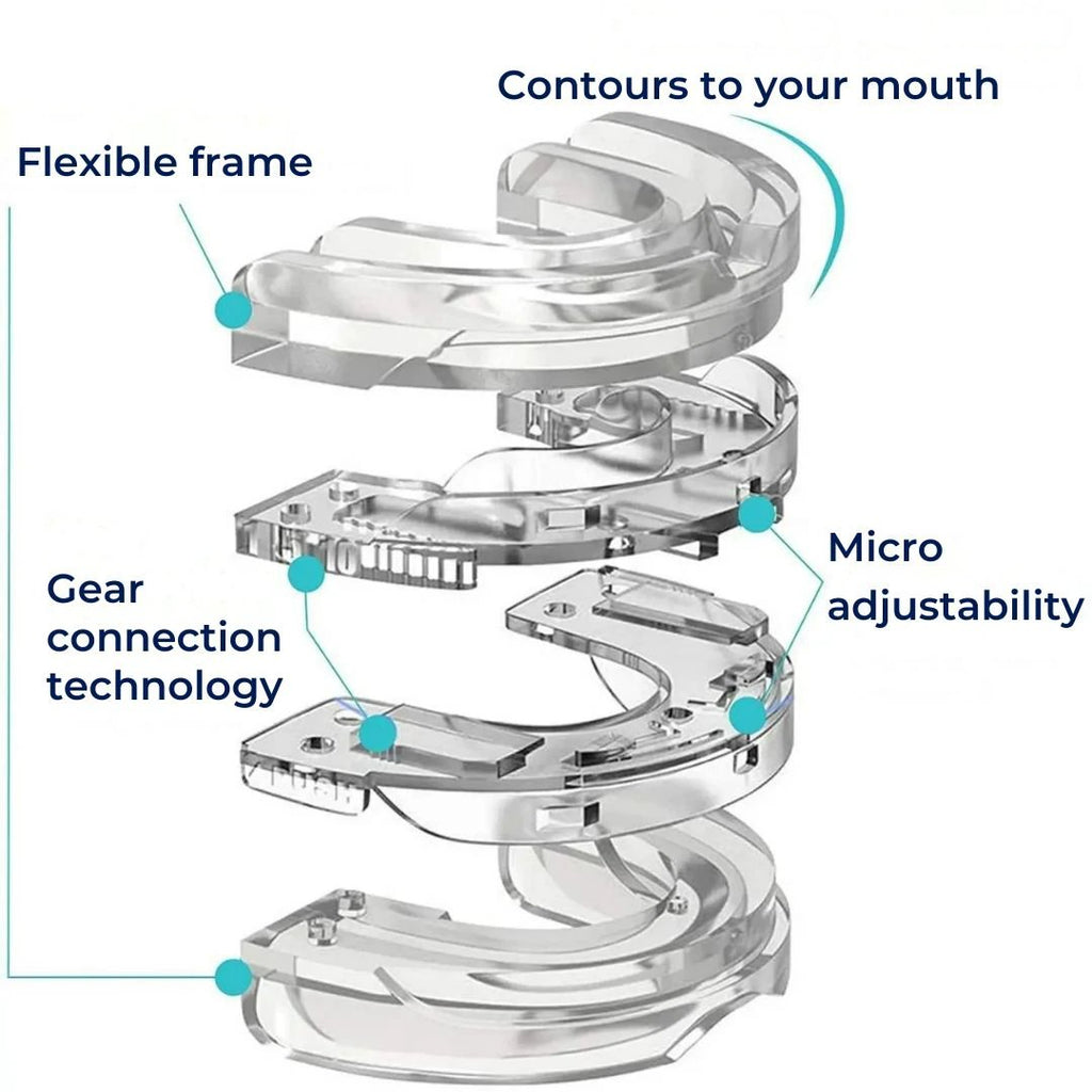 SilentEase | Anti-Snoring Mouth Device – Medical-Grade Silicone – Enhances Airflow – Ideal for Snorers Seeking Better Sleep Bowlift by Bowlift