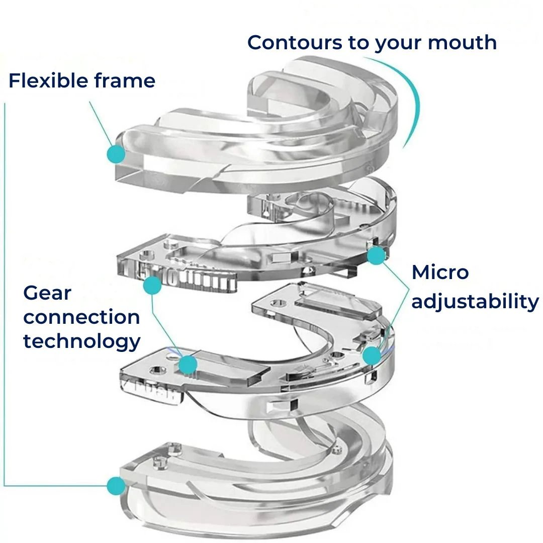 SilentEase | Anti-Snoring Mouth Device – Medical-Grade Silicone – Enhances Airflow – Ideal for Snorers Seeking Better Sleep Bowlift by Bowlift