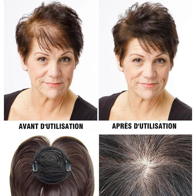 Replacement patch for wig by Bowlift