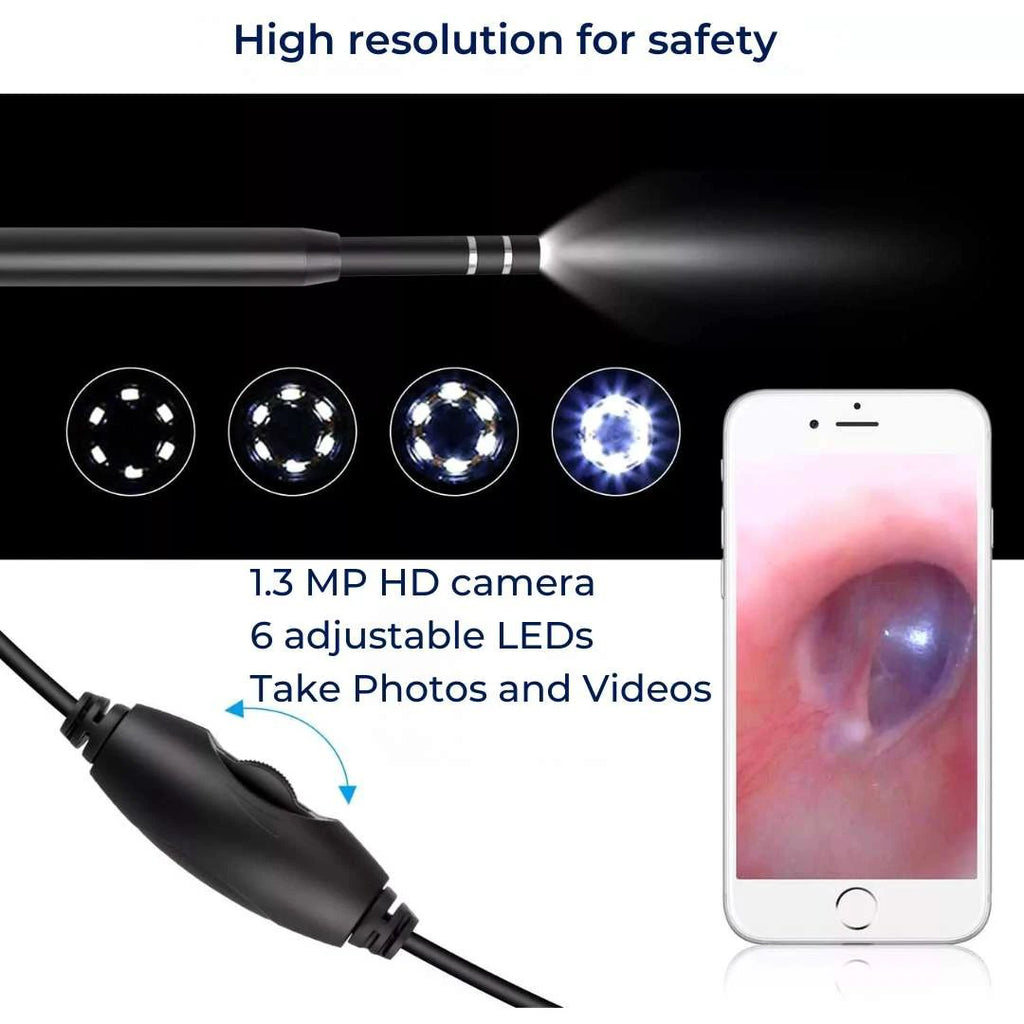EarVision Professional Ear Endoscope – HD Inspection – Live Monitoring – Capture Images & Video – Removes Wax & Foreign Objects Bowlift by Bowlift