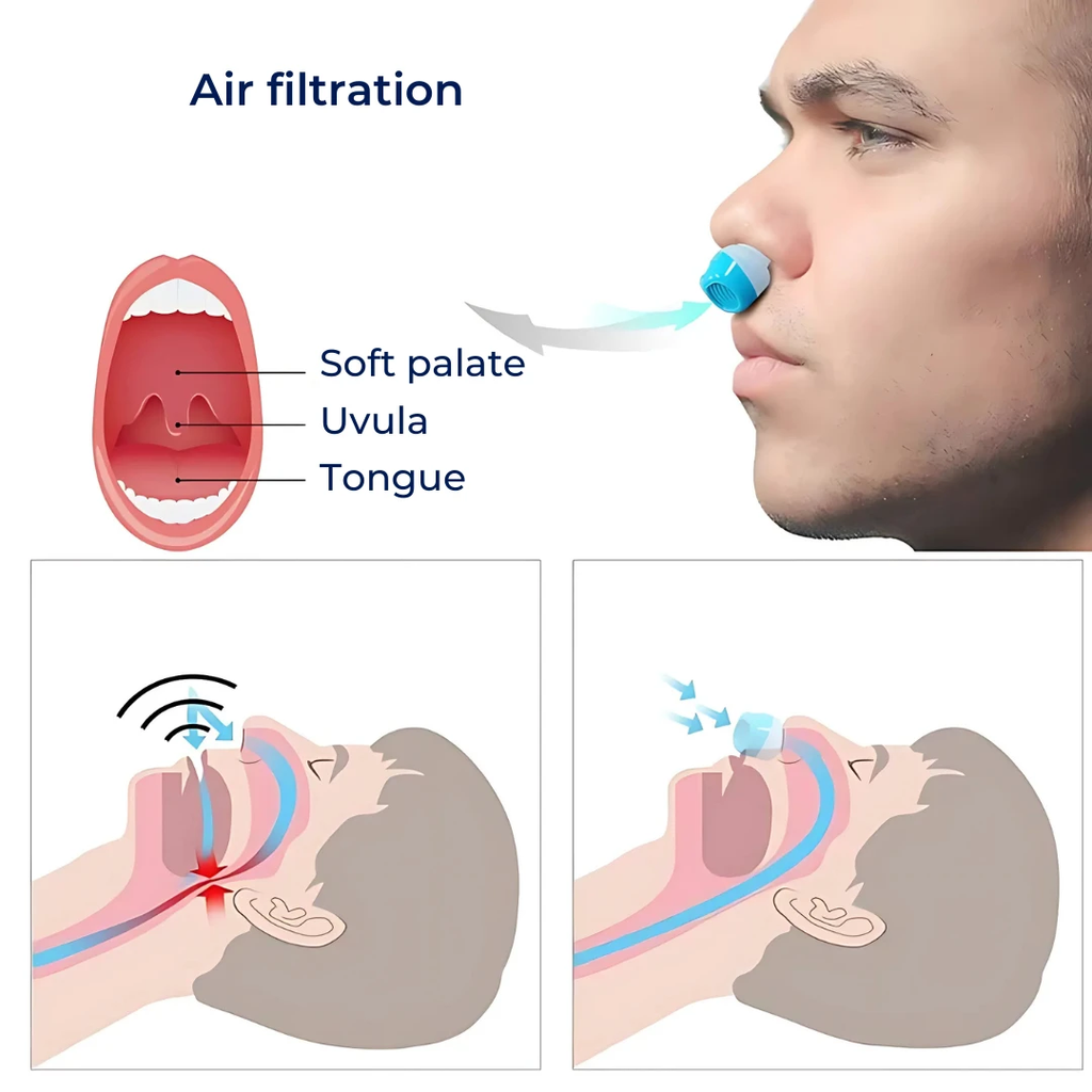 SilentEase | Anti-Snore Nasal Dilators – Snoring Relief – Soft Silicone – Comfortable Fit for Adults Bowlift by Bowlift