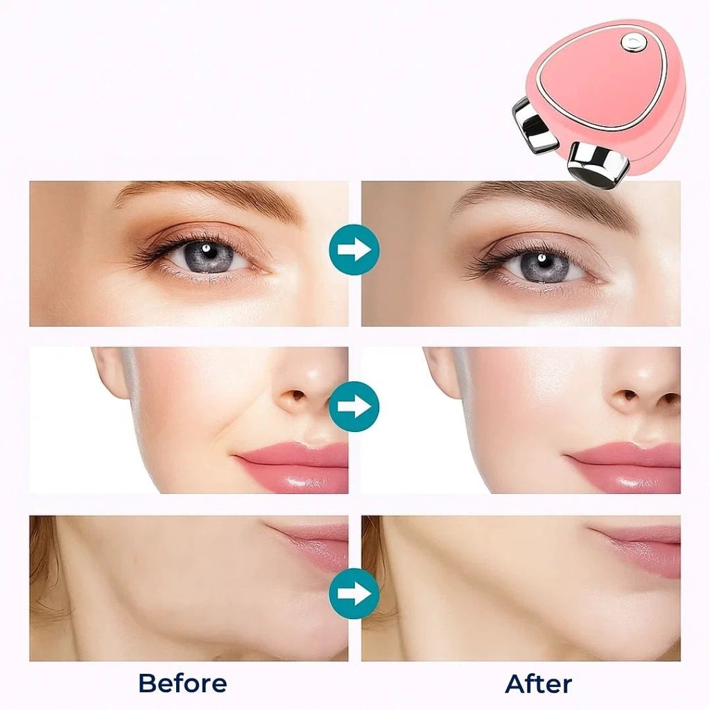 RejuvTone | EMS Facial Toner – Non‑surgical Lift – USB‑rechargeable Lightweight Device – Anti‑ageing Skincare Bowlift by Bowlift