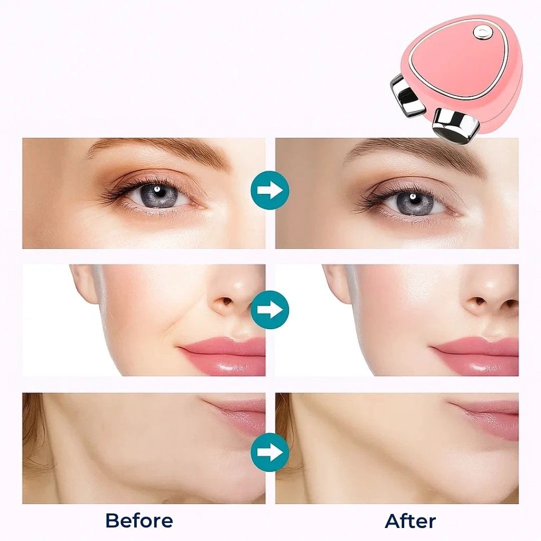 RejuvTone | EMS Facial Toner – Non‑surgical Lift – USB‑rechargeable Lightweight Device – Anti‑ageing Skincare Bowlift by Bowlift