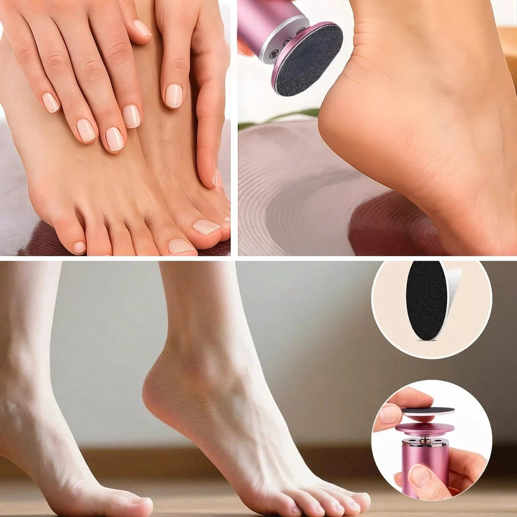 Hard Skin Removal – Waterproof Rechargeable – Restores Soft Smooth Feet Instantly Bowlift by Bowlift