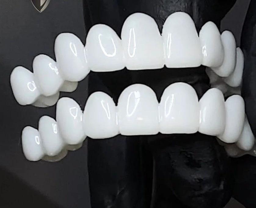 denture by Bowlift