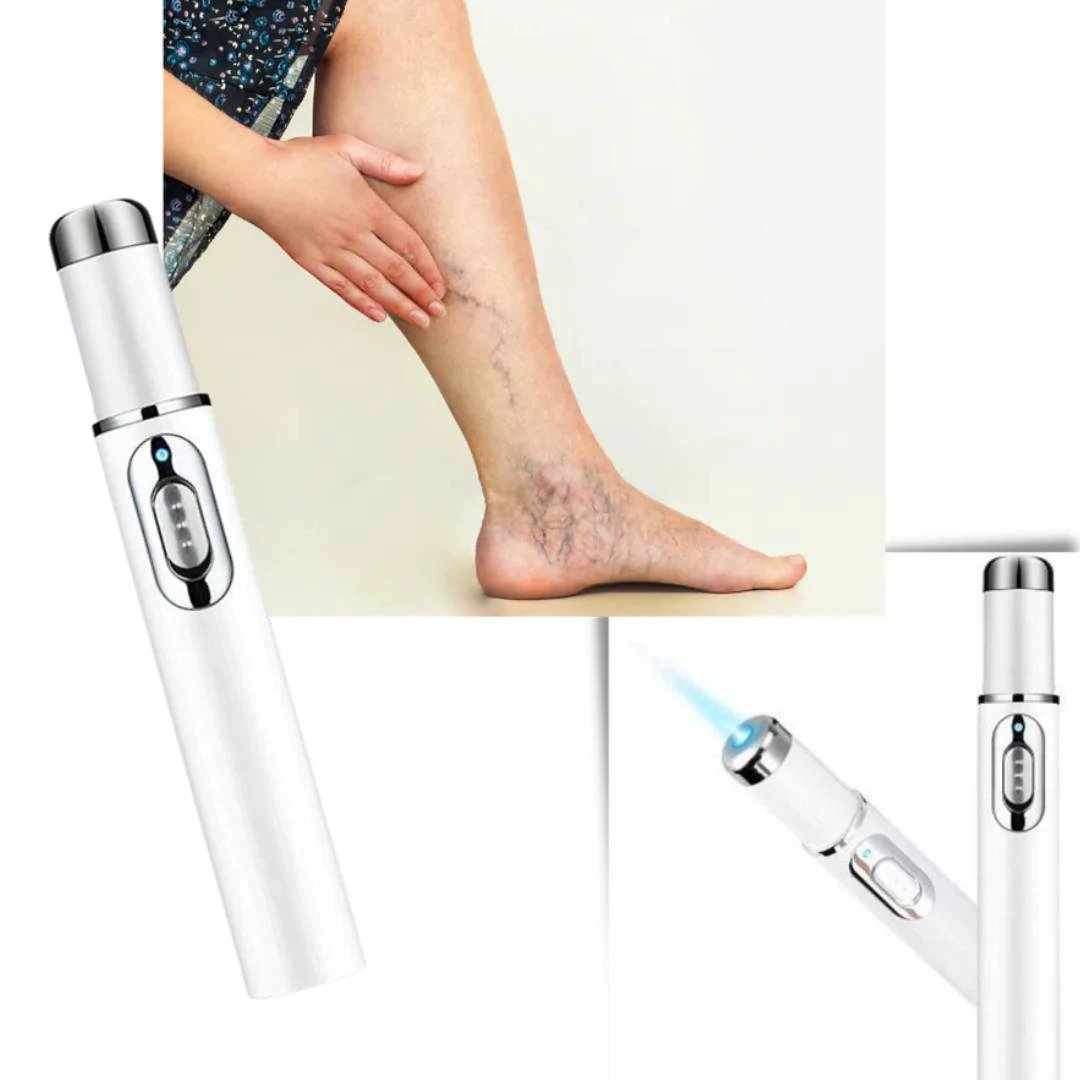 ClearGlow Blue Light Skin Therapy Pen | Acne Treatment - Anti-inflammatory - Non-invasive Solution - Clearer Skin - Blemish Reduction Bowlift by Bowlift