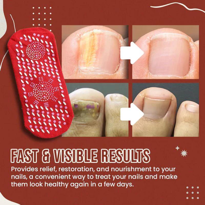 Nail Anti-Fungus Socks by BowLift