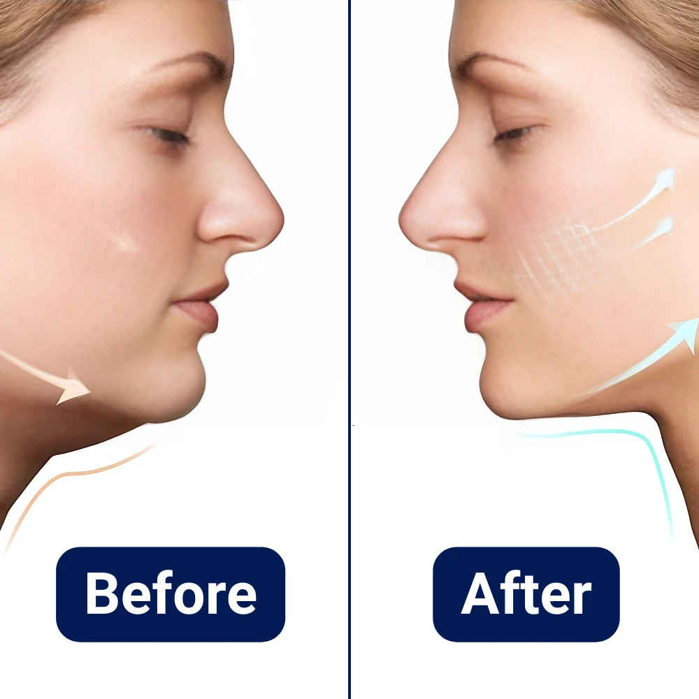 Facial Tightening Massager for Double Chin Reduction Bowlift by Bowlift