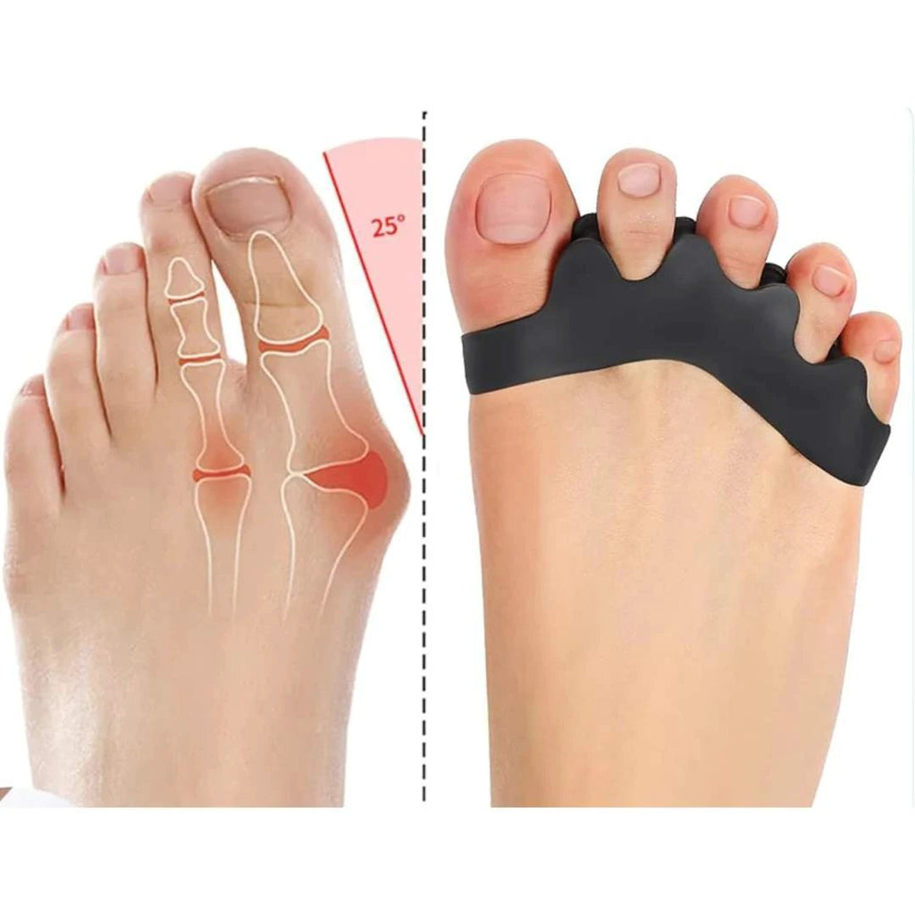 FlexAlign Toe Spacer | Toe Realignment and Pain Relief – Ideal for Bunions - Overlapping Toes - and Foot Comfort Bowlift by Bowlift
