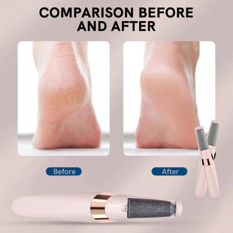 Electric Foot File Hard Skin Remover Bowlift by Bowlift