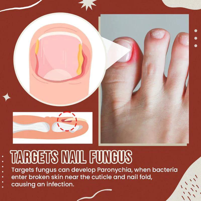 Nail Anti-Fungus Socks by BowLift