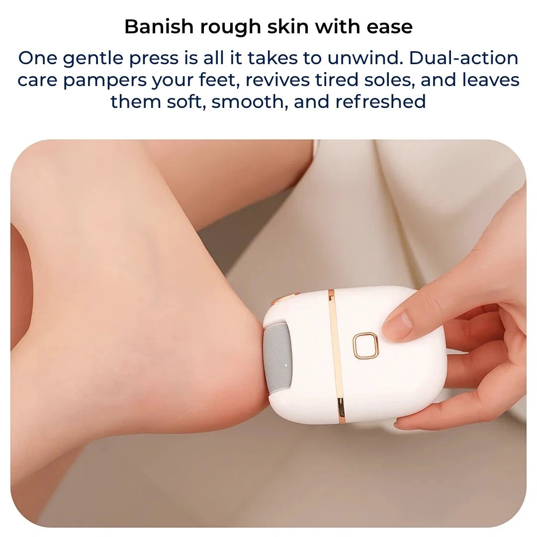 Callus Remover – Rechargeable Cordless – Heals Cracked Heels – Restores Soft, Smooth Feet at Home Bowlift by Bowlift