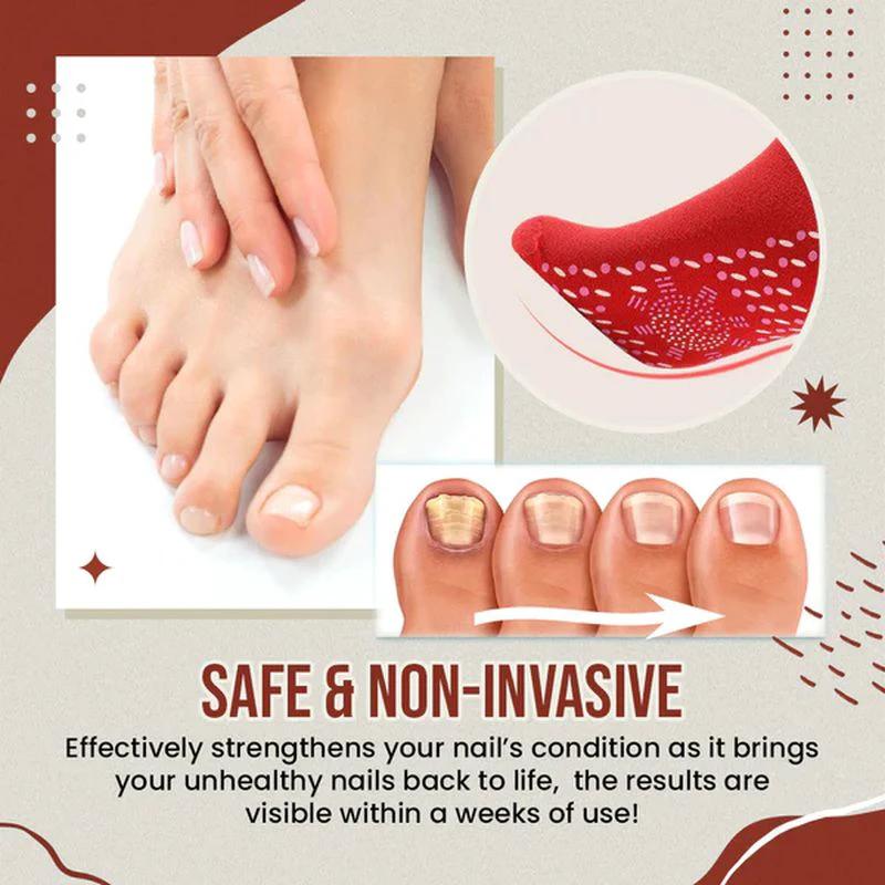 Nail Anti-Fungus Socks by BowLift