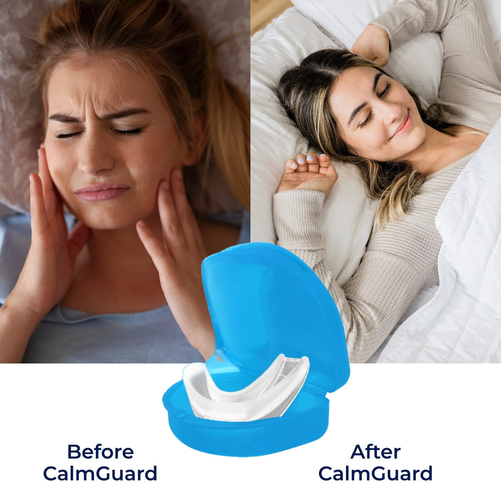 CalmGuard | Night Mouth Guard – Bruxism Relief – Custom-Fit – For Teeth Grinding & Jaw Clenching Bowlift by Bowlift