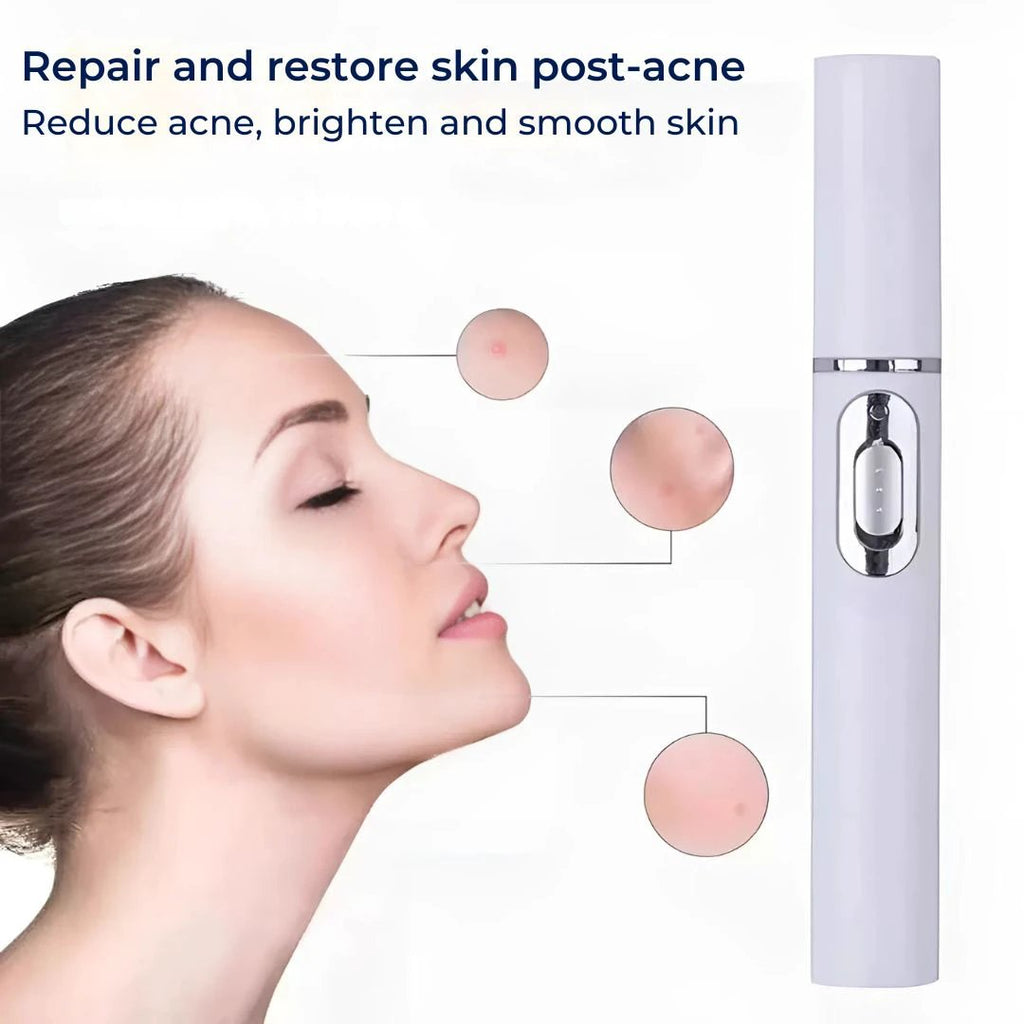 ClearGlow Blue Light Skin Therapy Pen | Acne Treatment - Anti-inflammatory - Non-invasive Solution - Clearer Skin - Blemish Reduction Bowlift by Bowlift