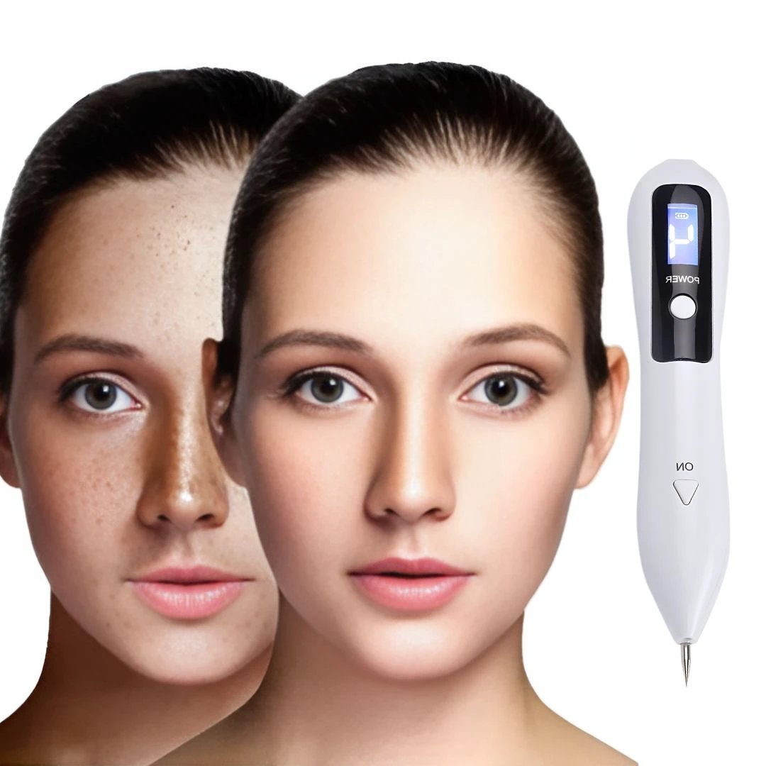 DermaGlow | Mole Removal Pen – Non-Invasive Plasma – Cordless & Rechargeable – At-Home Skin Tag & Freckle Treatment Bowlift by Bowlift