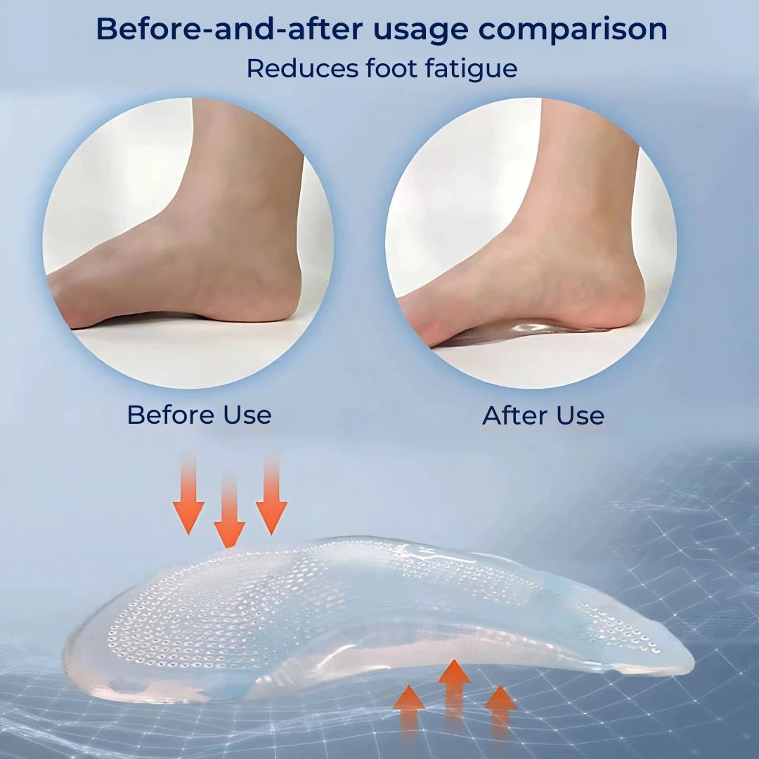 ComfortStep Gel Arch Support Insoles | Relieve Foot Pain - Reduce Fatigue - Improve Posture - Shock Absorbing Insoles Bowlift by Bowlift