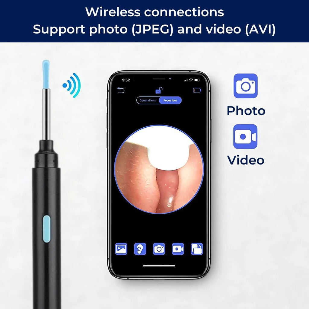 EarScope Pro - Smart Visual Earwax Removal Tool | LED Camera and Soft Tips - Safe and Precise Ear Cleaning Bowlift by Bowlift