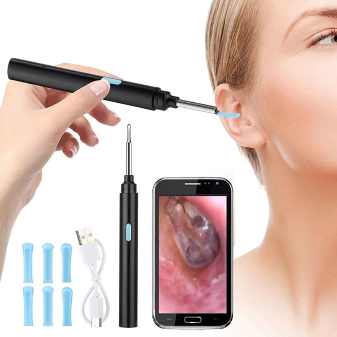 EarScope Pro - Smart Visual Earwax Removal Tool | LED Camera and Soft Tips - Safe and Precise Ear Cleaning Bowlift by Bowlift