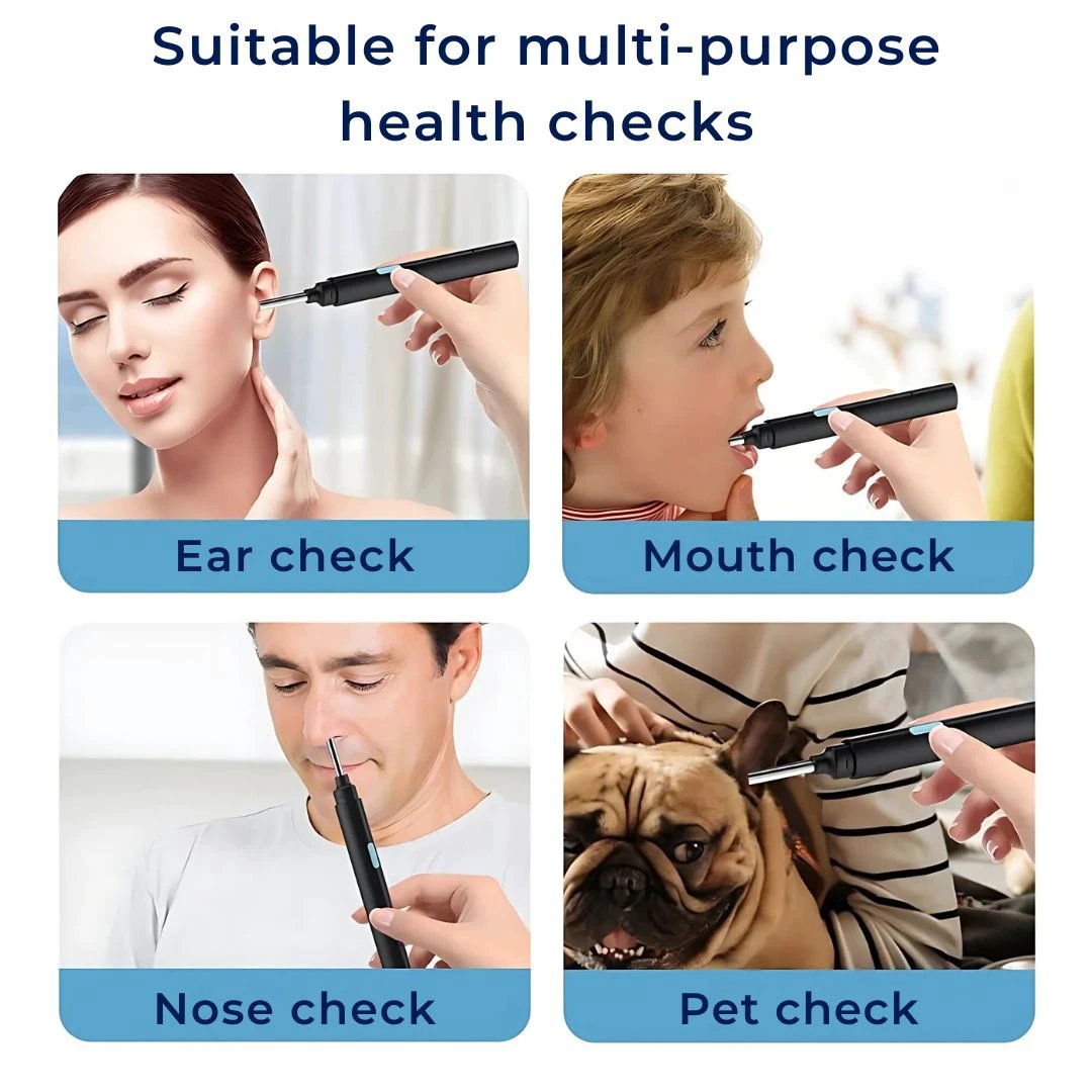 EarScope Pro - Smart Visual Earwax Removal Tool | LED Camera and Soft Tips - Safe and Precise Ear Cleaning Bowlift by Bowlift