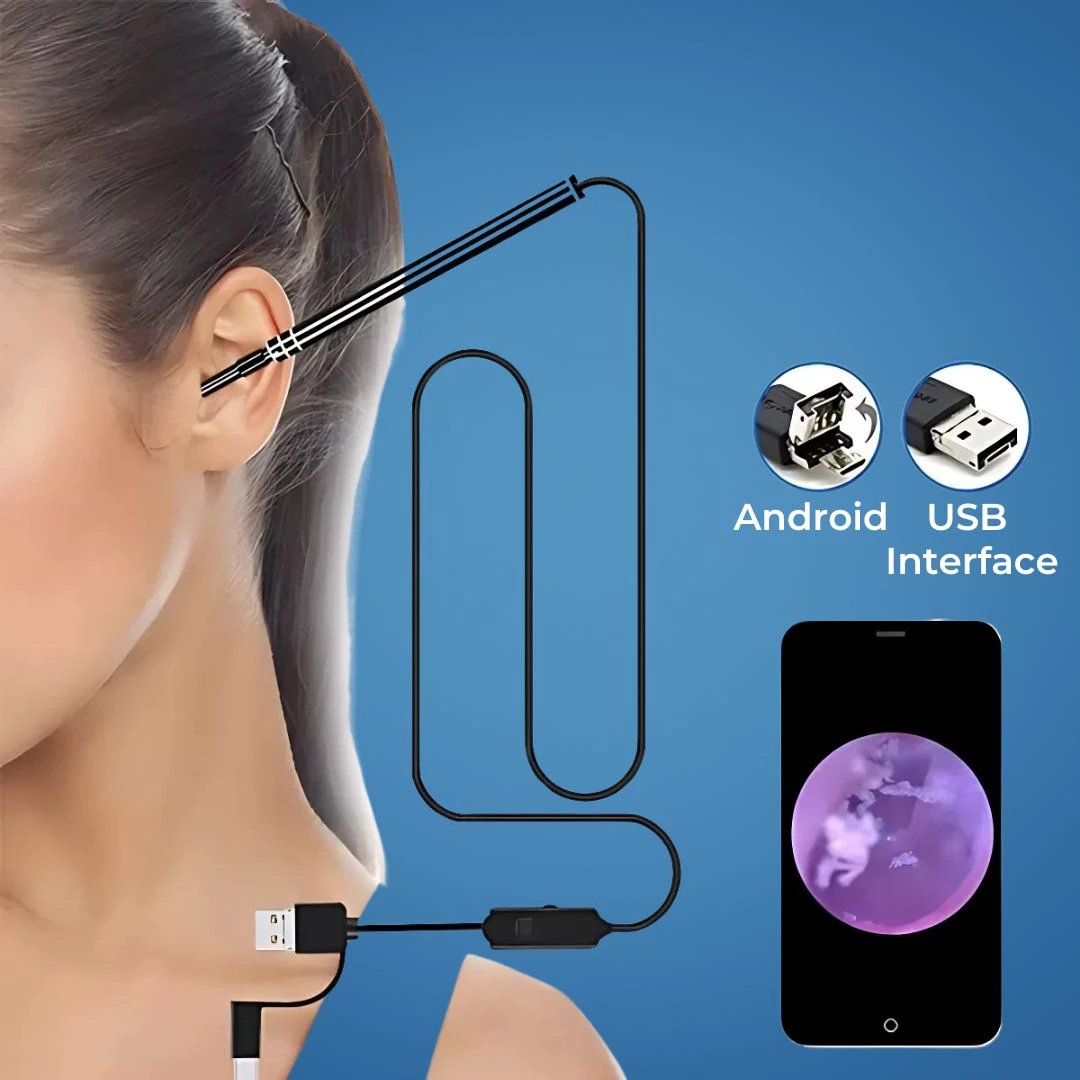 EarVision Professional Ear Endoscope – HD Inspection – Live Monitoring – Capture Images & Video – Removes Wax & Foreign Objects Bowlift by Bowlift