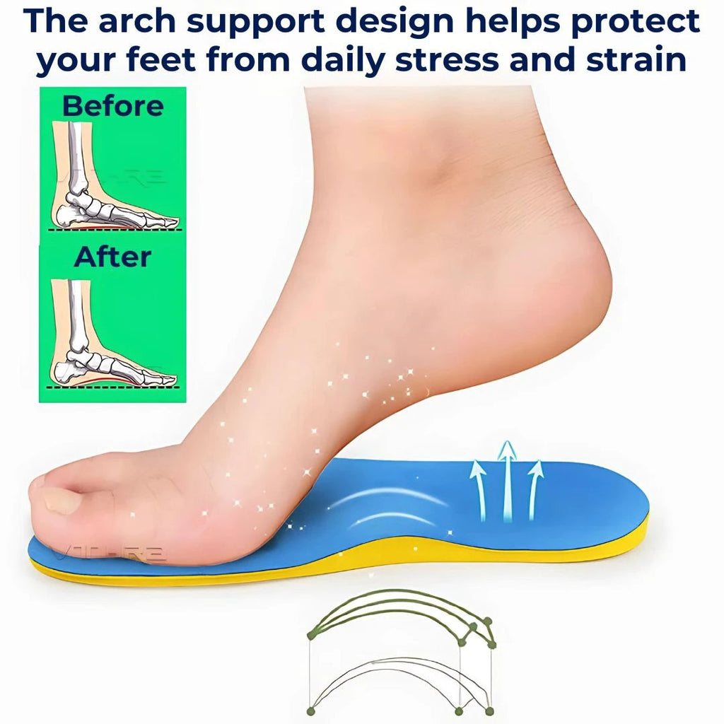 FootAlign Supination Insoles for Underpronation | Orthopedic Insoles - Foot Support - Daily Comfort Bowlift by Bowlift