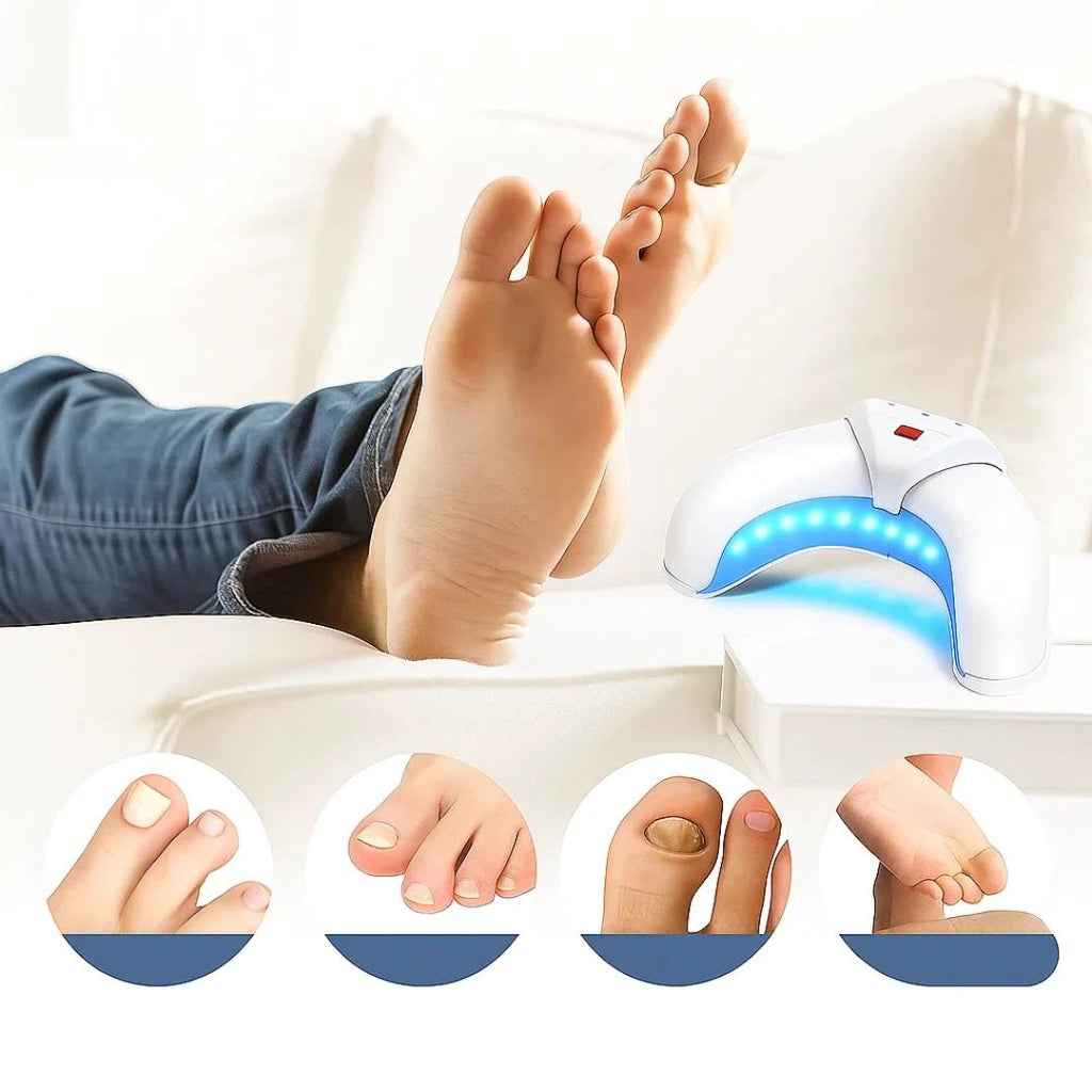 FungiFree | Laser Nail Fungus Device – Dual‑Wavelength Penetration – Compact Home Use – Fungal Nail Restoration Bowlift by Bowlift