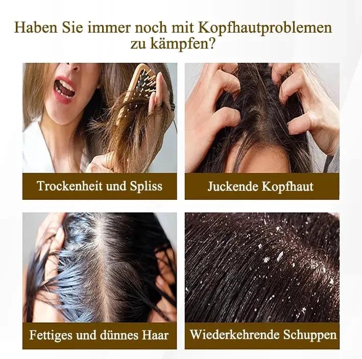 Scalp Massage Comb – Gentle Dandruff Removal & Care by BowLift