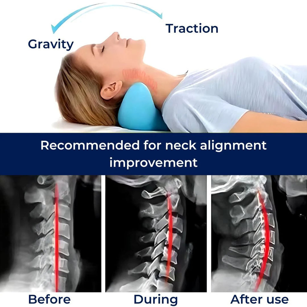 NeckAlign Chiropractic Neck Pillow | Stretcher for Neck - Pain Relief - Improved Posture - Better Sleep Bowlift by Bowlift