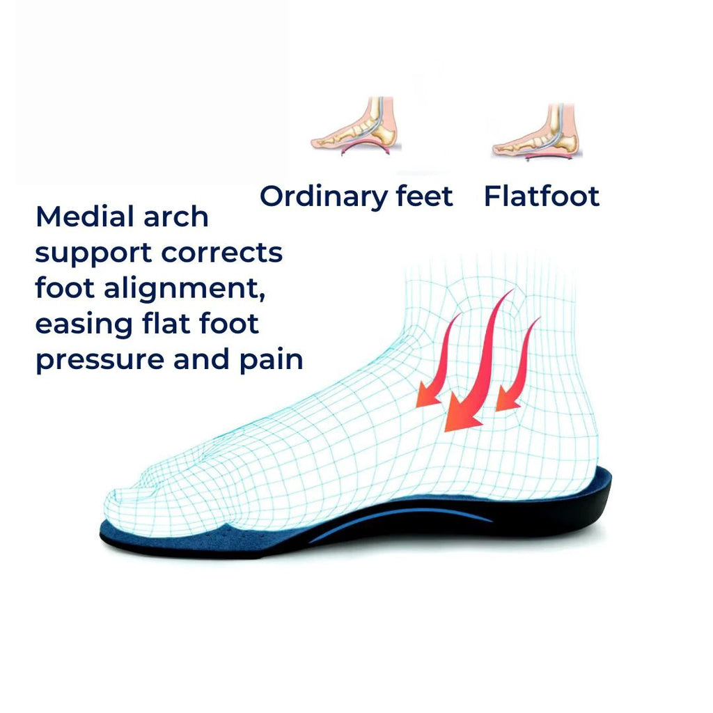 OrthoAlign Pronation Support | Inserts for Foot Alignment and Arch Relief - Orthopedic Shoe Inserts for Overpronation Correction Bowlift by Bowlift