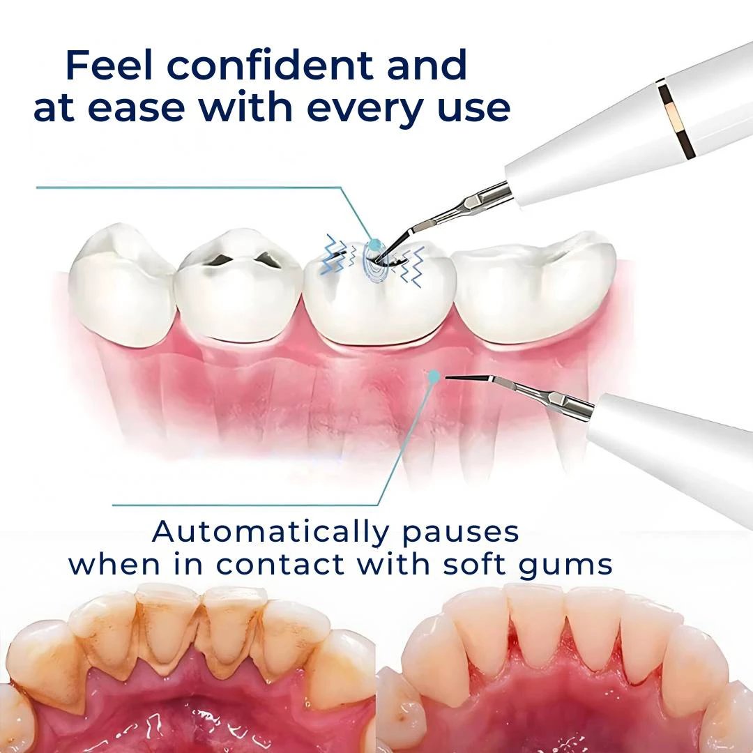 PlaqueFree Plaque Remover for teeth | Ultrasonic Teeth Cleaner - Tartar Remover from Home - Deep Teeth Cleaning and Polish Bowlift by Bowlift