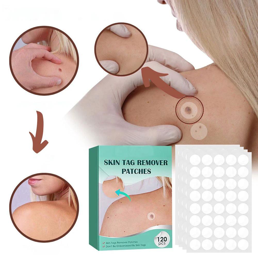 SkinClear - Plaster for the removal of spots and warts by BowLift
