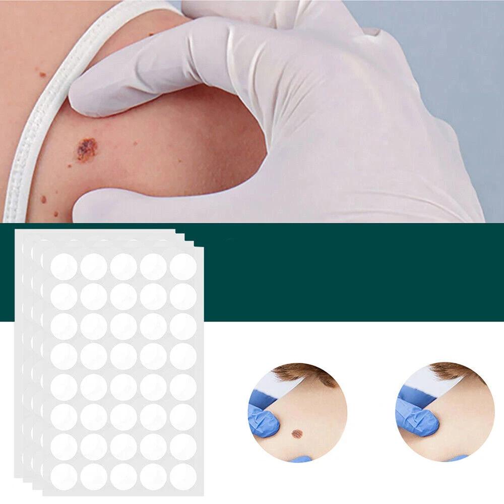 SkinClear - Plaster for the removal of spots and warts by BowLift