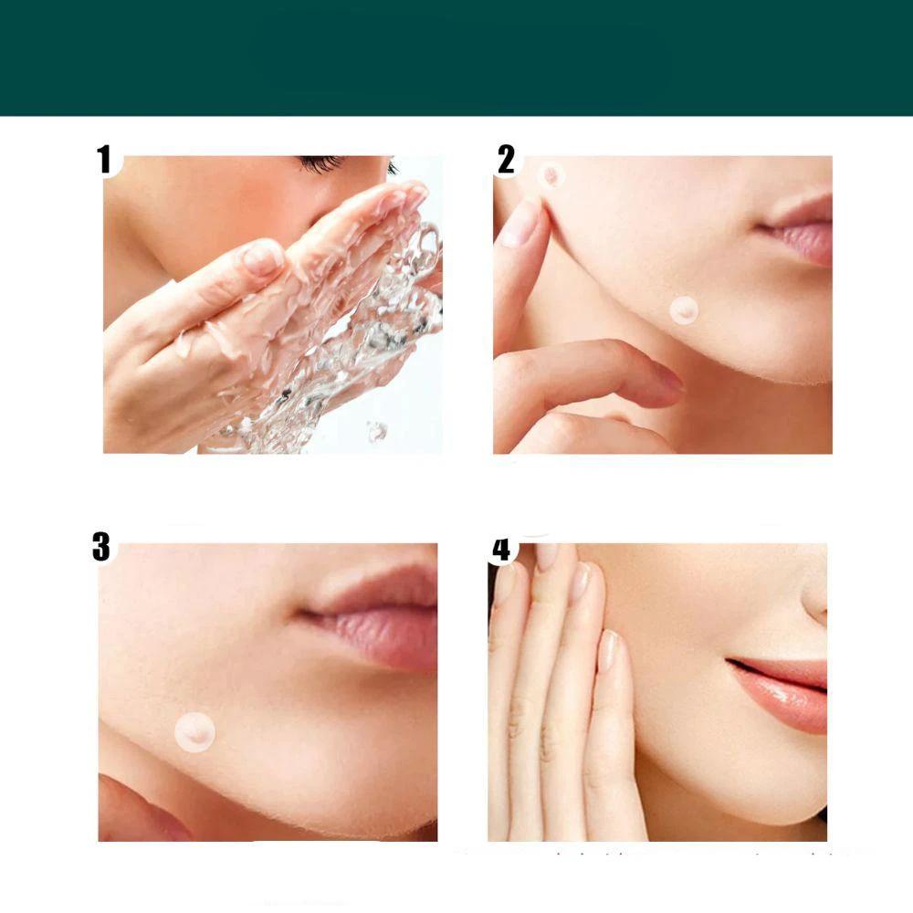SkinClear - Plaster for the removal of spots and warts by BowLift