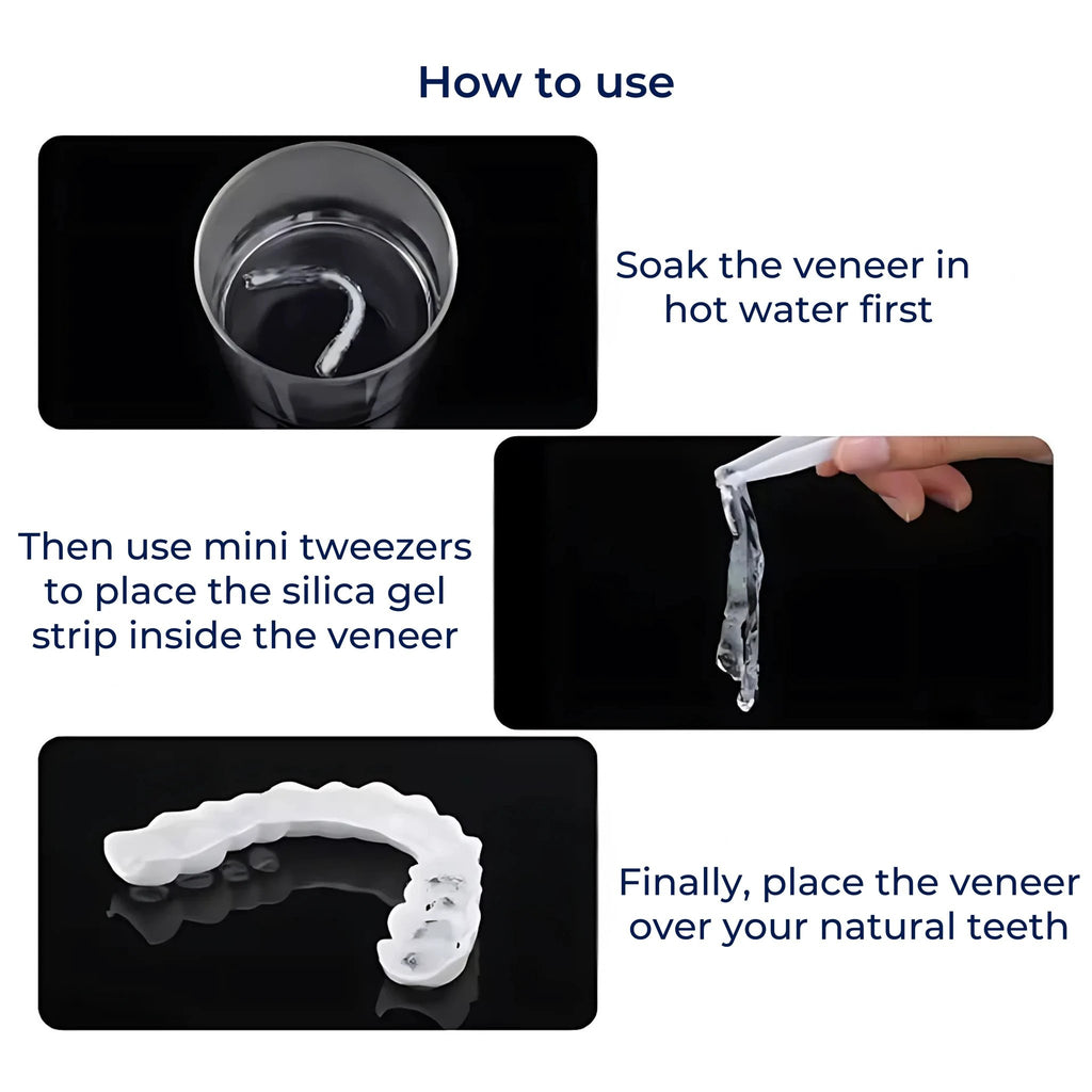 SmileEase | Clip-On Veneers – Instant Smile Enhancement – Ultra-Thin Design – Ideal for Adults Seeking Affordable Dental Solutions Bowlift by Bowlift