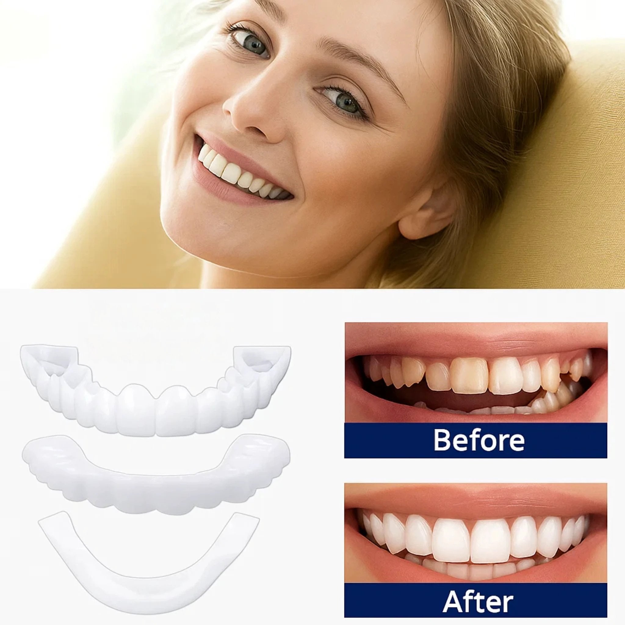 SmileEase | Clip-On Veneers – Instant Smile Enhancement – Ultra-Thin Design – Ideal for Adults Seeking Affordable Dental Solutions Bowlift by Bowlift