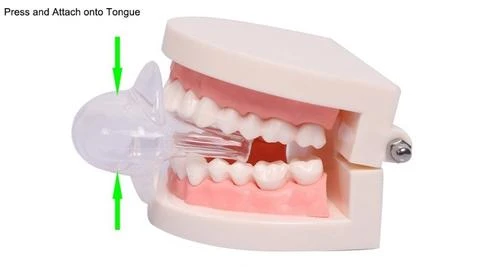 Apnea Tongue Stabilizing Device by BowLift