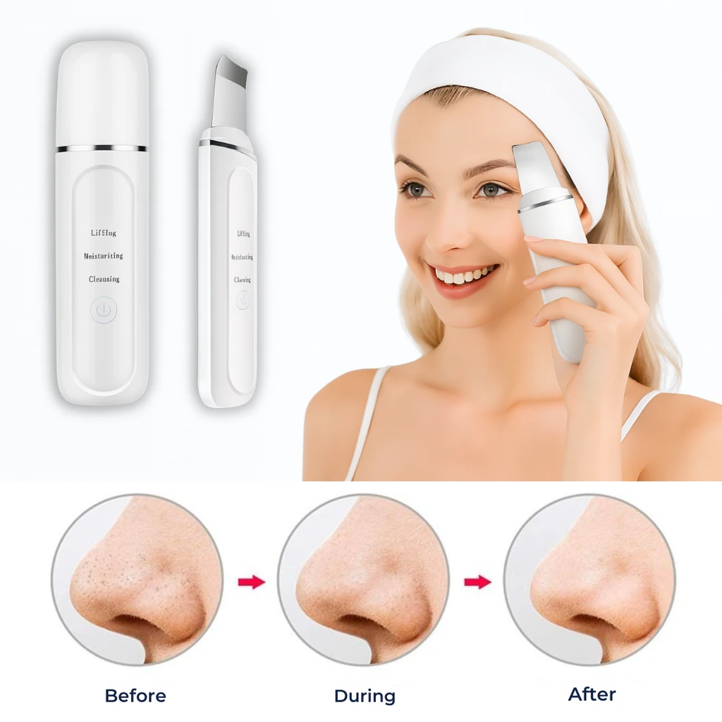 GlowSonic | Ultrasonic Facial Wand – Deep Cleansing – 33,000 Vibrations – At-Home Skincare Tool Bowlift by Bowlift